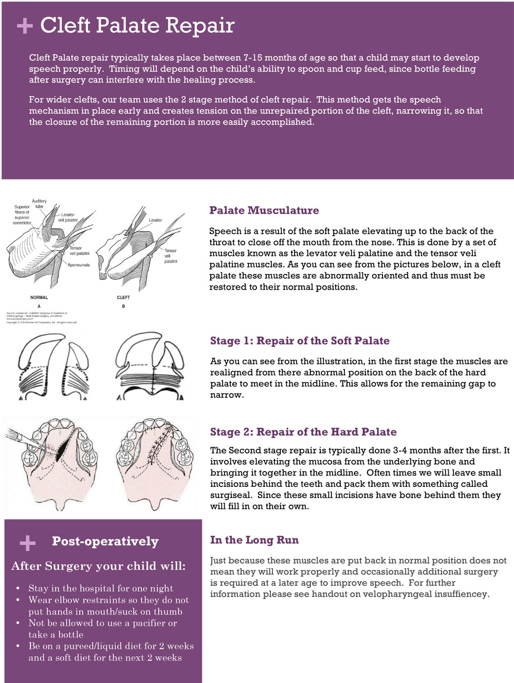 Cleft Palate Repair Brouchure