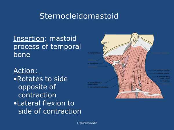 sternocleidomastoid